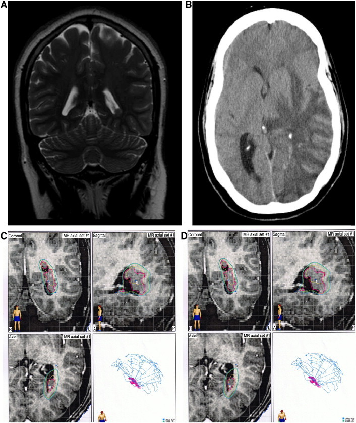 Fig. 2