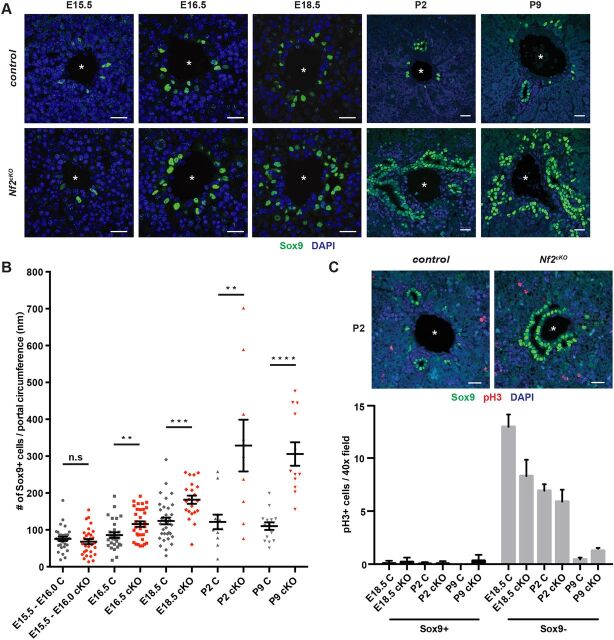 Fig. 1. Proliferation-independent expansion of biliary cells in the embryonic Nf2cKO liver. (A) Representative confocal images showing the number and distribution of Sox9+ (green) cells in control and Nf2cKO mouse livers at E15.5, E16.5, E18.5, P2 and P9. Portal veins are marked by asterisks. (B) Quantitation of the number of Sox9+ cells per portal circumference at the specified stages. n.s, not statistically significant; **P<0.01, ***P<0.001, ****P<0.0001 (Student's t-test). Each data point represents an individual portal space. Sample sizes [control (C), Nf2cKO (cKO) embryos]: E15.5-E16.0 (9, 10), E16.5 (12, 5), E18.5 (10, 5), P2 (4, 3), P9 (4, 2). (C) Sections from P2 control and Nf2cKO livers stained for Sox9 and pH3 (top), along with a quantitation of proliferating (pH3+) Sox9+ and Sox9− cells (bottom). Values are mean±s.e.m. Sample sizes (control, Nf2cKO embryos): E18.5 (3, 4), P2 (3, 3), P9 (2, 2). Scale bars: 20 µm.