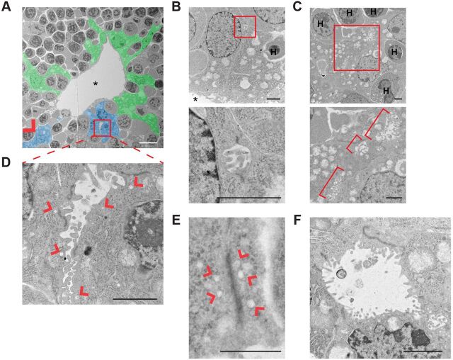 Fig. 4. Ultrastructural analysis of de novo lumen formation during biliary morphogenesis in control livers. (A) Transmission electron micrograph of a portal space in a control E15.5 liver pseudo-colored to show ductal plate cells (blue) that form microlumens flanked by electron-dense junctions (red box and arrowhead) along shared boundaries with parenchymal hepatoblasts (also blue) in this plane of section. Other ductal plate cells that do not form de novo lumens in this plane of section are shown in green; many envelop hematopoietic cells (gray surrounded by green). Portal vein is marked by an asterisk. (B-F) High-magnification of examples of developing luminal structures generated by ductal plate cells in control E15.5-E16.5 livers. Boxed areas (B,C) are magnified beneath. (B) Microlumen (∼1 µm) filled with microvilli and flanked by electron-dense cell junctions formed at the ab-endothelial boundary between two ductal plate cells. (C) Tandem microlumens along boundaries between two ductal plate cells and one parenchymal hepatoblast (brackets). (D) Expanding lumen (2-6 µm) filled with microvilli and flanked by electron-dense cell junctions and associated vesicular structures (arrowheads). (E) Elongated electron-dense cell junction without microlumens but clearly associated with vesicular structures (arrowheads). (F) Open lumen with fewer microvilli surrounded by wedge-shaped cells that are connected by electron-dense apical junctions. H, hematopoietic cell. Scale bars: 10 µm in A; 2 µm in B-D,F; 1 µm in E.