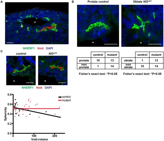 Fig. 6. 3D aspects of developing IHBDs. (A) Representative rendering showing complex 3D architecture of developing control E16.5 livers (from Movie 1). (B) Representative developing prolate (control) and oblate (Nf2cKO) lumens labeled with NHERF1 (green), along with their frequencies in E16.5 livers (bottom). Fisher's exact test was used to compare the ratios of prolate:non-prolate or oblate:non-oblate in control versus mutant. (C) Representative luminal cavities (voids, red; top) and graph of sphericity as a function of void volume in control and Nf2cKO E16.5 livers (bottom). Linear regression reveals that sphericity declines as a function of volume in control (*P<0.05) but not in Nf2cKO (n.s.). Each data point represents one luminal void volume. Sample size (control, Nf2cKO): E16.5 (4, 3). Asterisks, portal vein. Values shown are mean±s.e.m. Scale bars: 20 µm in A; 10 µm in B,C.