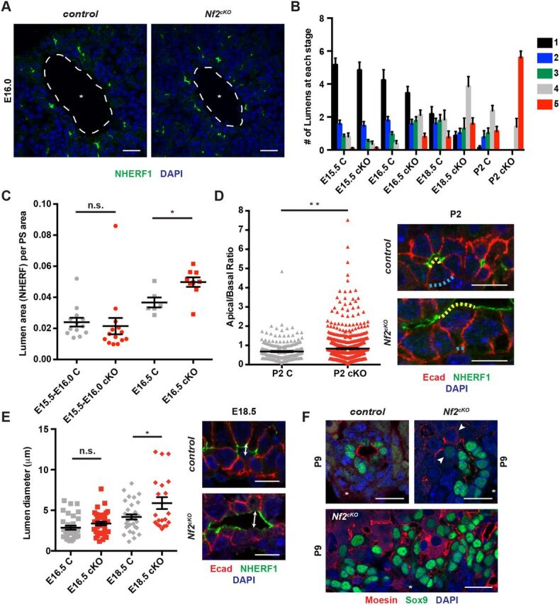 Fig. 5. Altered lumen expansion in the Nf2cKO liver. (A) Representative confocal images of similarly sized NHERF1+ lumens in E16.0 control and Nf2cKO livers. (B) Frequency of each IHBD stage (from Fig. 3) in control and Nf2cKO livers of various ages. Sample size (control, Nf2cKO): E15.5 (5, 9), E16.5 (3, 4), E18.5 (4, 3), P2 (6, 4). (C) Quantitation of NHERF1+ lumen surface in control and Nf2cKO livers at E15.5-E16.5. PS, portal space. n.s., not statistically significant; *P<0.05 (Student's unpaired t-test). Each data point represents one lumen surface. Sample size (control, Nf2cKO): E15.5-E16.0 (4, 3), E16.5 (5, 3). (D) Variation of apical width [ratio of apical (yellow dotted line in representative confocal images) to basal (blue dotted line) width] in control and Nf2cKO P2 livers. **P<0.01 (Mann–Whitney test). Each data point represents an individual cell. Sample size (control, Nf2cKO): P2 (4, 3). (E) Luminal opening in E16.5-E18.5 livers measured as the maximal distance between the apical surface of the ductal plate cell and that of overlying parenchymal cells (lumen diameter, left) as shown (arrow) on representative confocal images (right). *P<0.05 (Student's unpaired t-test). Each data point represents an individual lumen. Sample size (control, Nf2cKO): E16.5 (4, 3), E18.5 (5, 3). (F) Representative confocal images depicting the relationship between moesin+ lumen and Sox9+ cells in biliary structures from control (top left) and Nf2cKO (top right and bottom) P9 livers. Arrowheads indicate moesin+ lumen extending into the parenchyma in Nf2cKO. Asterisks, portal vein. Values shown are mean±s.e.m. Scale bars: 10 µm in D,E; 20 µm in A,F.