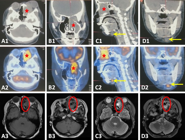 Fig 1