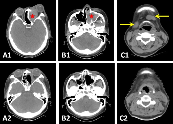 Fig 2