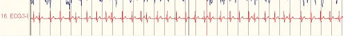 Figure 1C