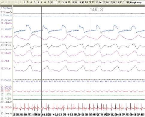 Figure 1A