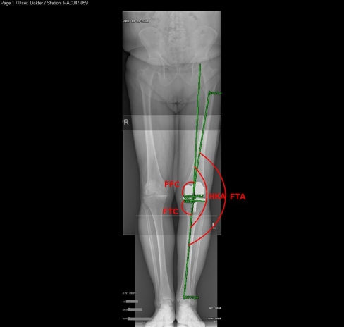 Fig. 1