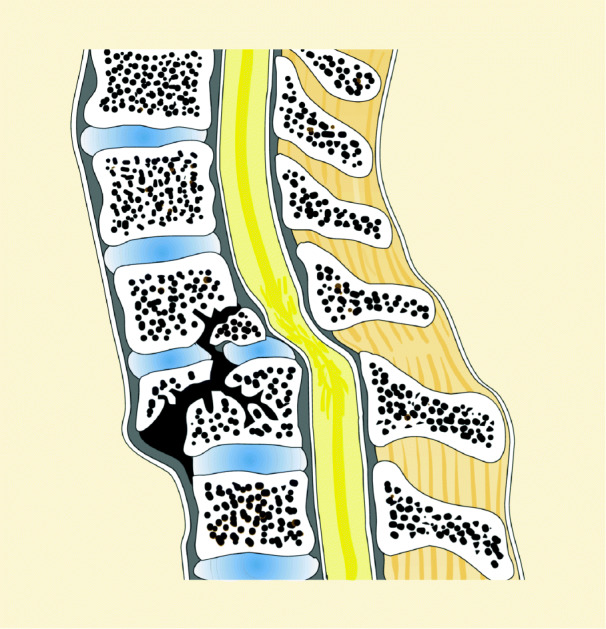 graphic file with name 6376_9_De_61_Fig6_HTML.jpg