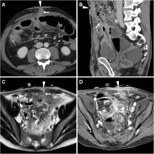 Fig. 11