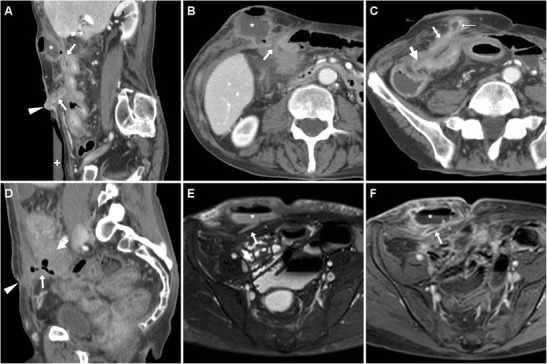 Fig. 10