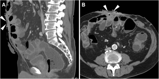 Fig. 5