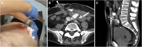 Fig. 2