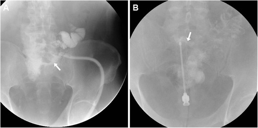 Fig. 1