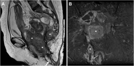 Fig. 13