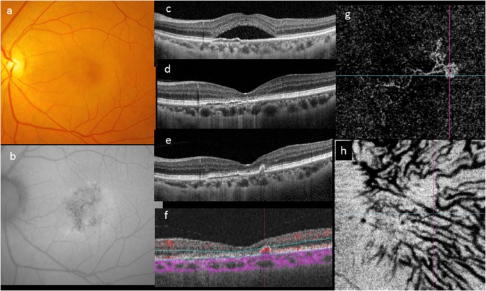 Fig. 3