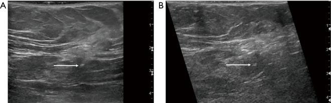 Figure 22