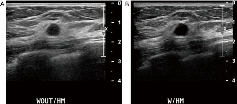 Figure 29