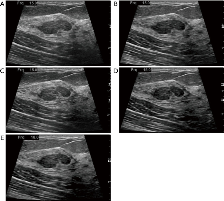 Figure 15