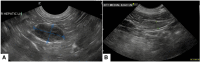 FIG 1