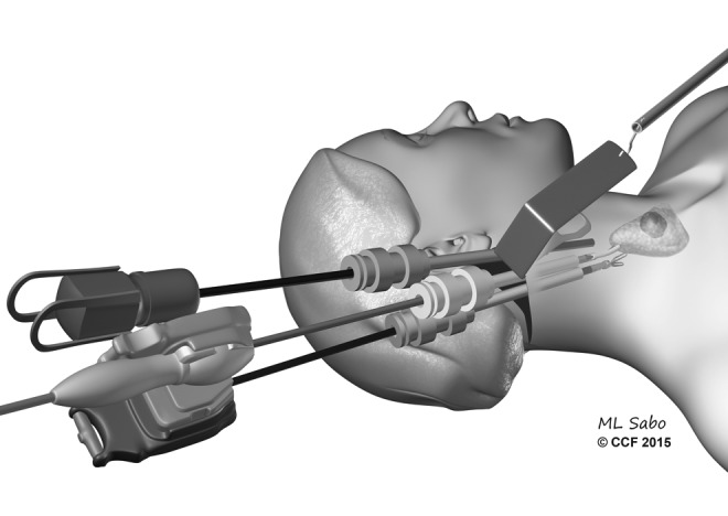 FIG. 3.