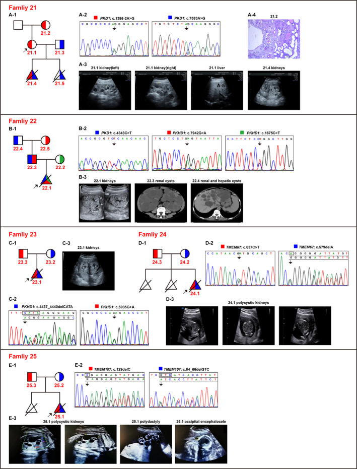 FIGURE 3