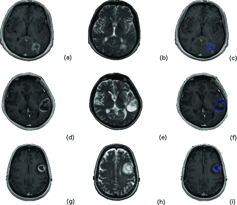 FIG. 3.