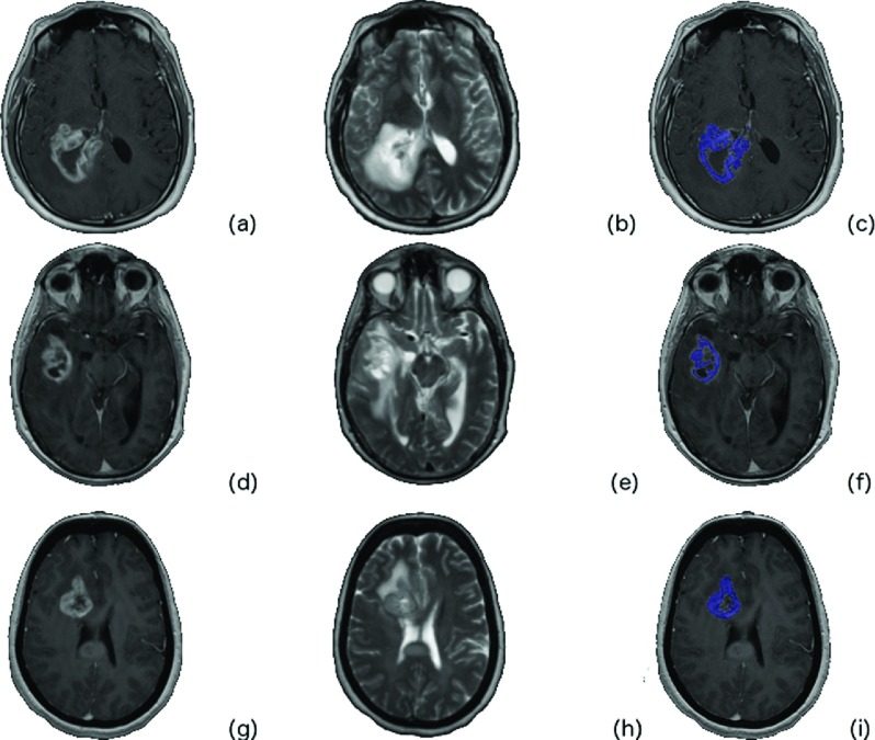 FIG. 2.