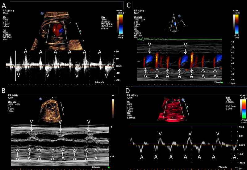 Figure 3: