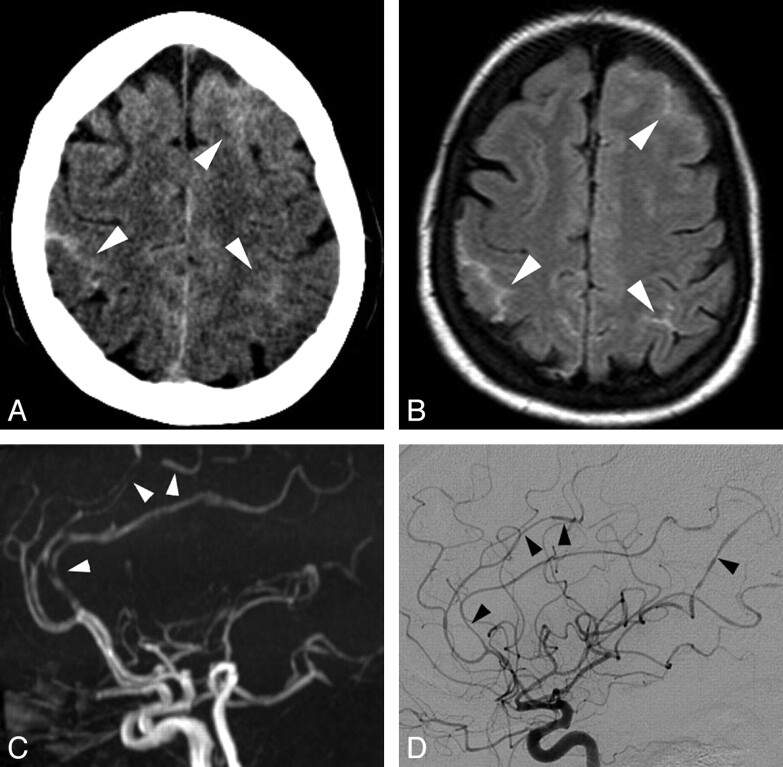 Fig 4.