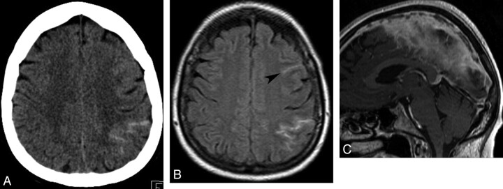 Fig 3.