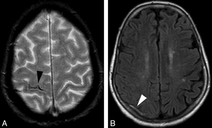 Fig 2.