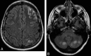 Fig 7.