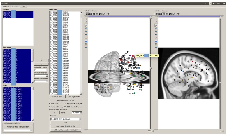 Figure 11