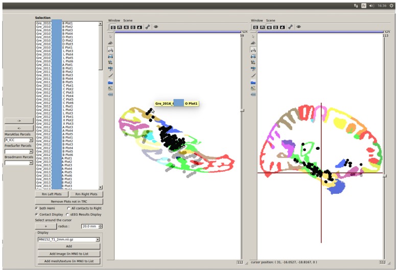 Figure 12