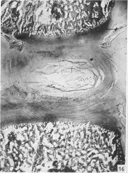 Fig. 16