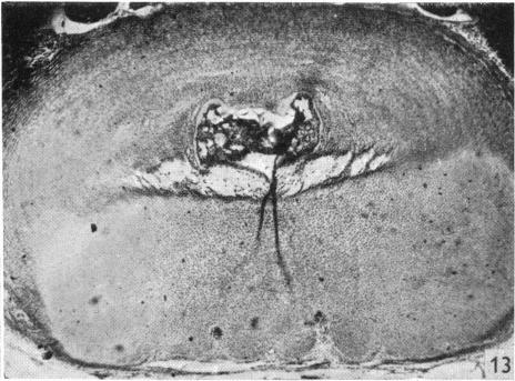 Fig. 13