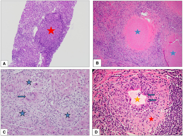 FIG 3