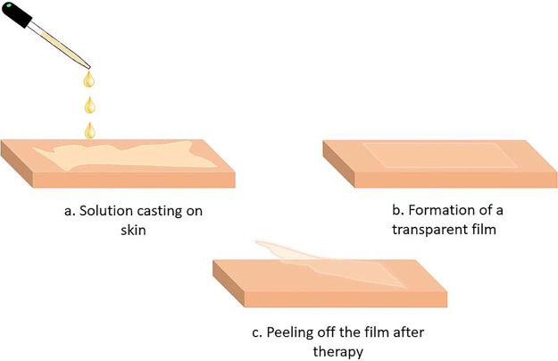 Fig. 4