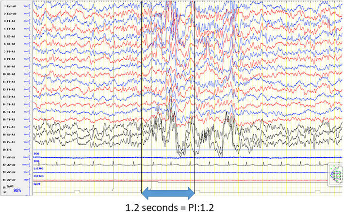 FIGURE 1