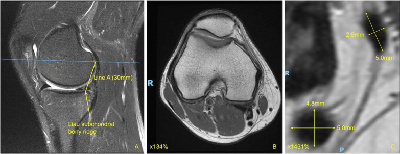 Fig. 3