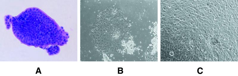 FIG. 1