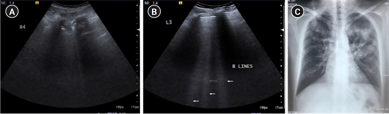 Figure 15.