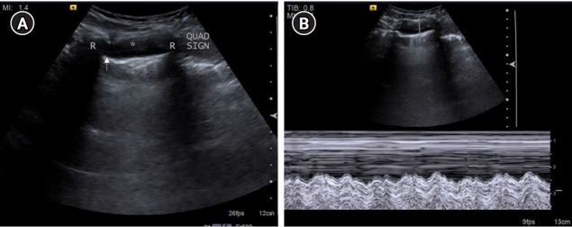 Figure 14.