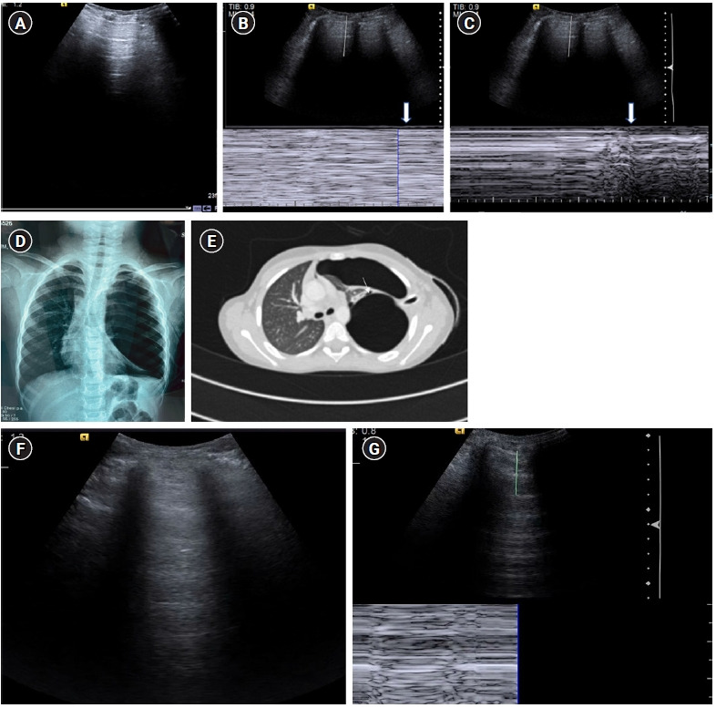 Figure 11.