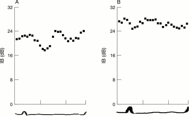 Figure 4  