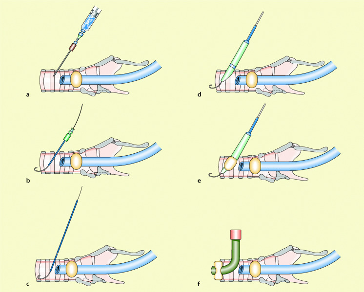 graphic file with name 6376_9_De_55_Fig8_HTML.jpg