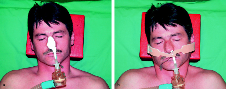 graphic file with name 6376_9_De_55_Fig3_HTML.jpg