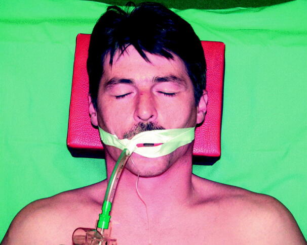 graphic file with name 6376_9_De_55_Fig1_HTML.jpg