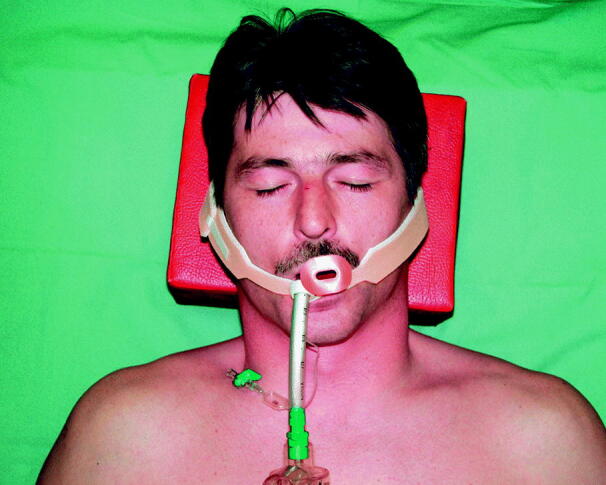 graphic file with name 6376_9_De_55_Fig2_HTML.jpg