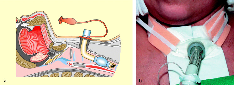 graphic file with name 6376_9_De_55_Fig6_HTML.jpg