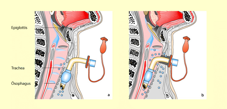graphic file with name 6376_9_De_55_Fig7_HTML.jpg